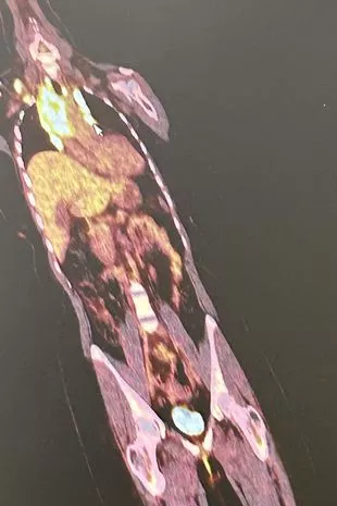 “我以为我的腿是因为润肤霜而变红的,但其实是更致命的东西。”