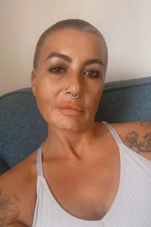 “我的速效液体BBL开始腐烂——疼痛比分娩还严重。”