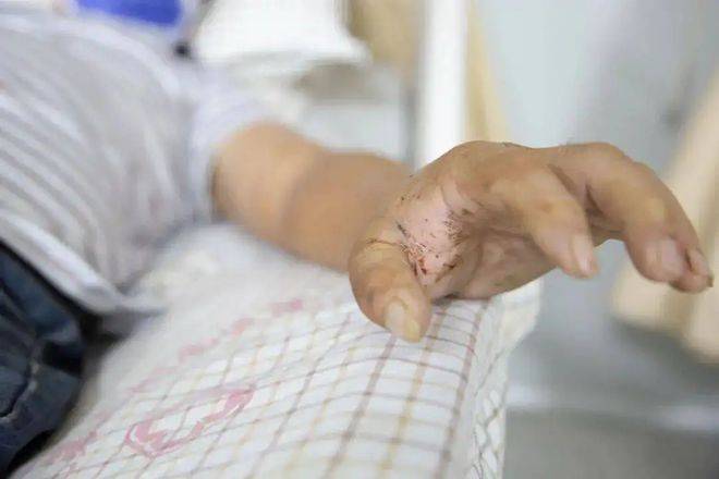 独生女疑被蛇咬伤身亡，生命的脆弱与家庭之痛